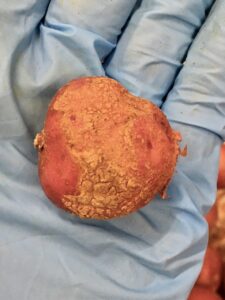 Red new potato with Elephant skin disorder